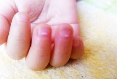 星空体育品牌-孩子指甲这样,是怎么了，山东国康